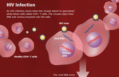 HIV infection